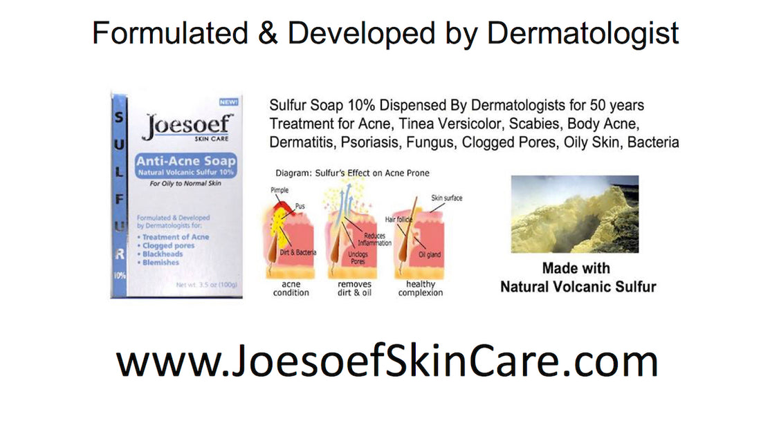 Sulfur Soap Acne Treatment approved by Dermatologists for 60 years