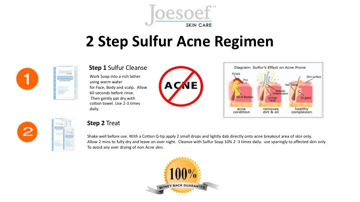 Sulfur Soap for Acne - Joesoef Skin Care Sulfur Soap 4 pack - Free Shipping